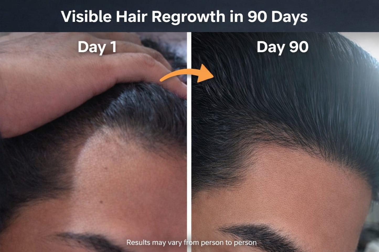 Nutraji Advanced Hair Growth Supplement for Hair Fall Control & Hair Density